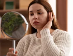 Atasi Fungal Acne: Panduan Lengkap Pengobatan dan Pencegahannya