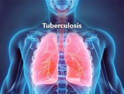 Ribuan Warga Indonesia Ikut Uji Klinis Global Vaksin TBC M72 6 Ribuan Warga Indonesia Ikut Uji Klinis Global Vaksin TBC M72